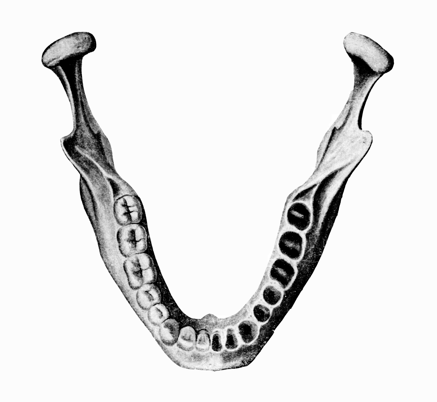 Зуб без кости. Нижняя челюсть кость анатомия. Зубные альвеолы нижней челюсти. Нижняя челюсть кость анатомия человека. Мед универ нижняя челюсть.