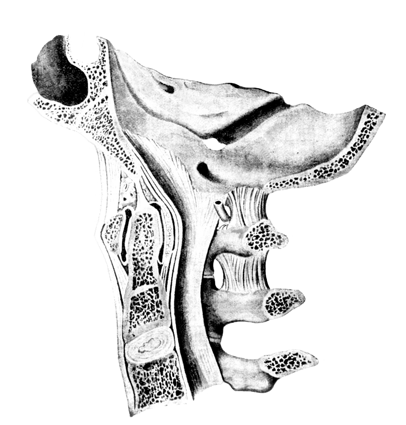 Соединения между затылочной костью. Атланто окципитальный сустав. Анатомия атланто затылочного сустава кт. Атлантозатылочный сустав анатомия. Обызвествление связок в атланто-аксиальном суставе.