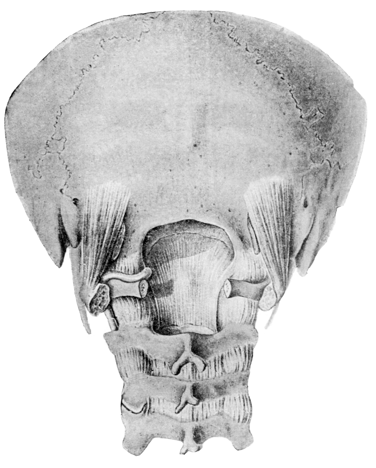 Череп задняя часть. Выйная кость. Мыщелок черепа. Затылочная кость черепа. Мыщелок затылочной кости.